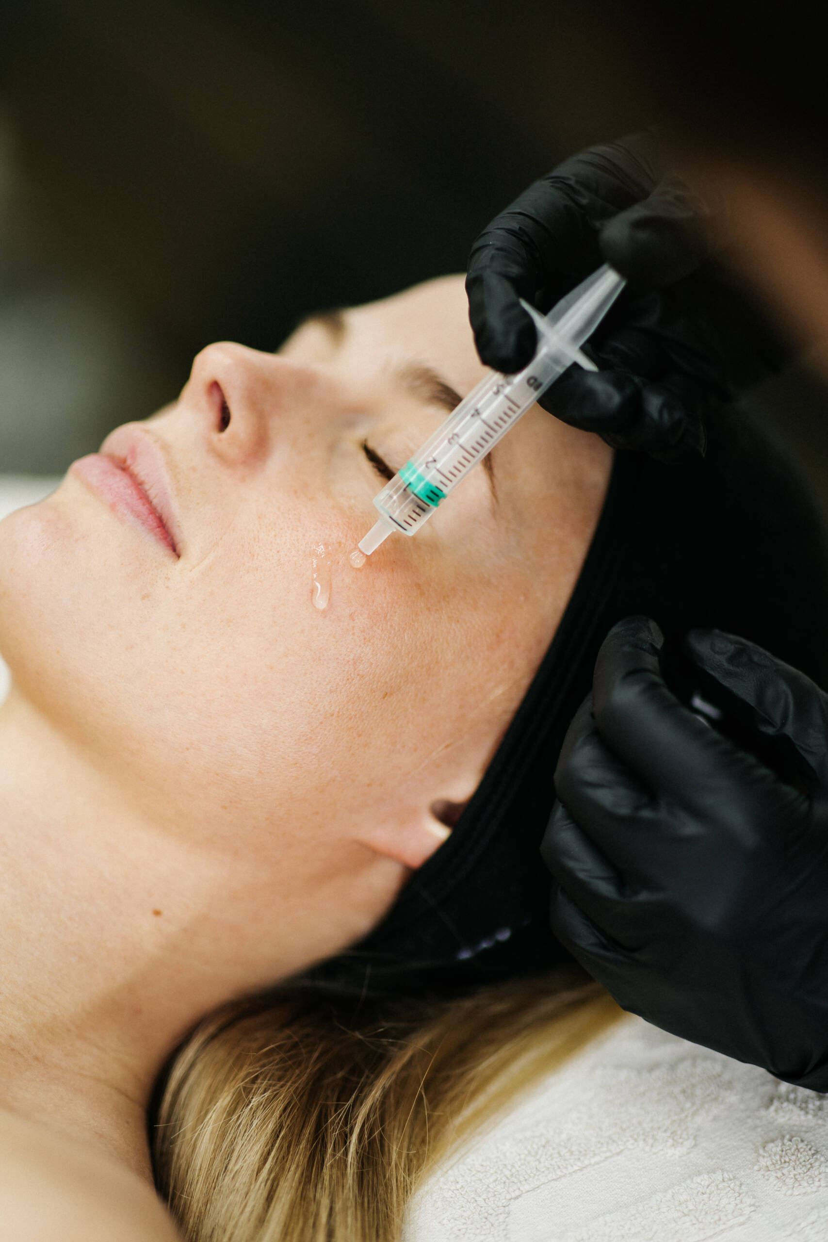 Eclat skin & spa Microneedling in Udenhout, nabij Tilburg